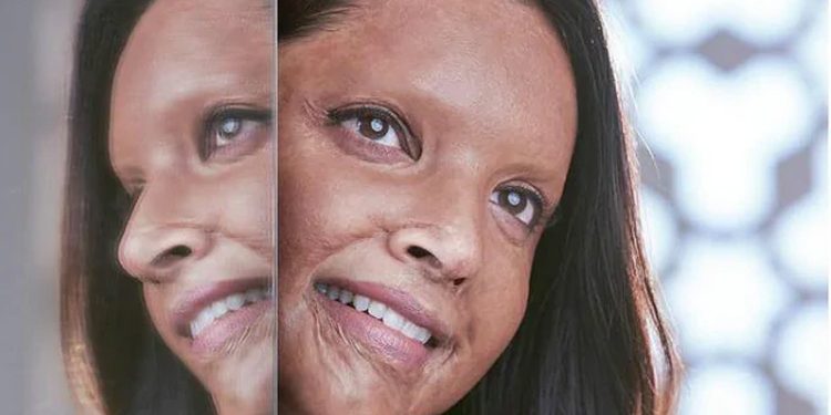 অ্যাসিডে আক্রান্ত দীপিকা, ট্রেলারেই বাজিমাত ‘ছাপাক’!